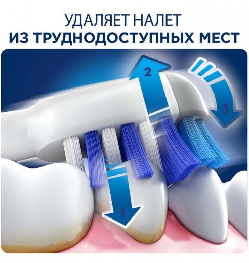 Насадка для зубных щеток Oral-B TriZone EB 30-3 (3 шт)